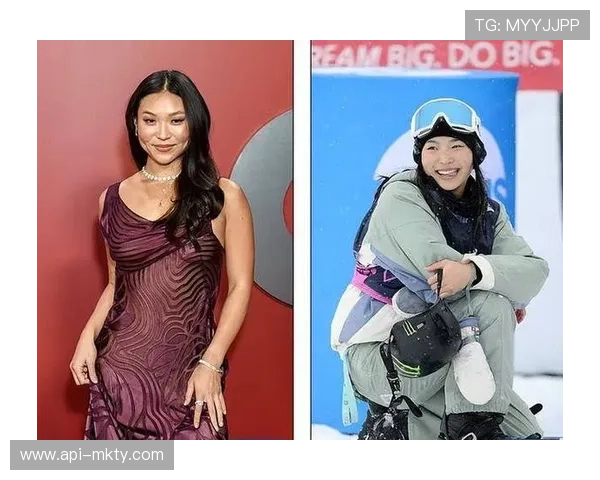 克洛伊·金肩部脱臼后更新社交媒体，坦言“处在非常艰难的状况中”情绪起伏